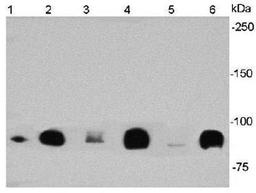 Western blot analysis of A431(Lane 1) SW480(Lane 2) HCT116(Lane 3) HT-29(Lane 4) Mouse colon(Lane 5) Mouse brain(Lane 6) using Beta Catenin antibody