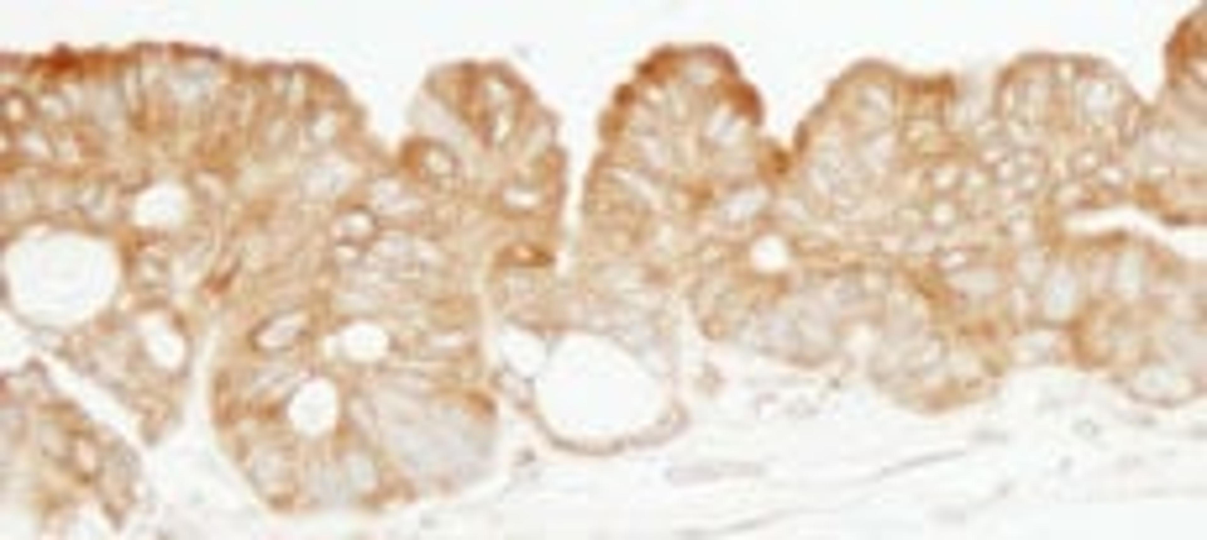 Detection of human KARS by immunohistochemistry.