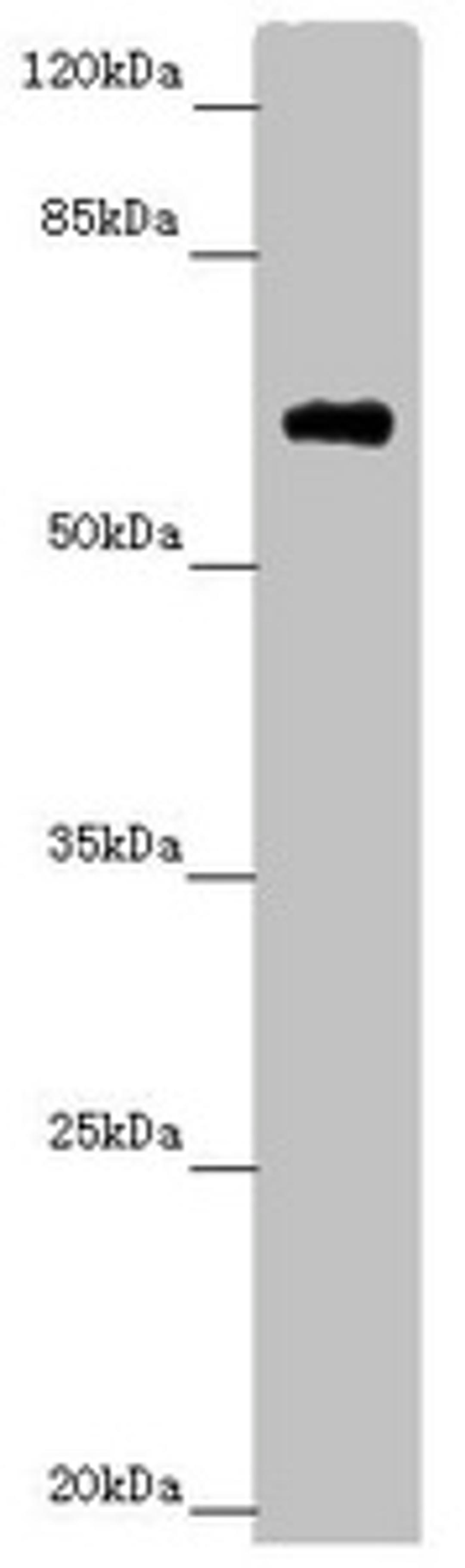 Western blot. All lanes: SOCS4 antibody at 4.25 ug/ml.  + Mouse kidney tissue. Secondary. Goat polyclonal to rabbit IgG at 1/10000 dilution. Predicted band size: 60 kDa. Observed band size: 60 kDa. 