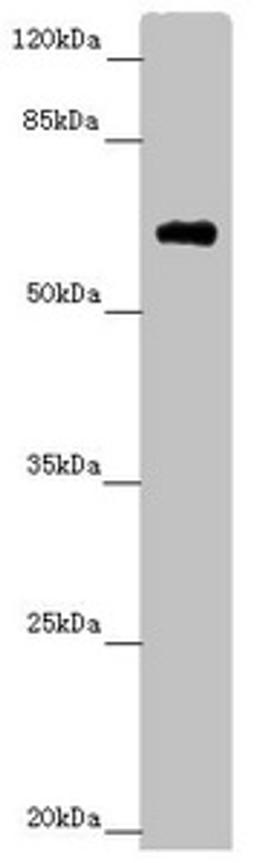 Western blot. All lanes: SOCS4 antibody at 4.25 ug/ml.  + Mouse kidney tissue. Secondary. Goat polyclonal to rabbit IgG at 1/10000 dilution. Predicted band size: 60 kDa. Observed band size: 60 kDa. 