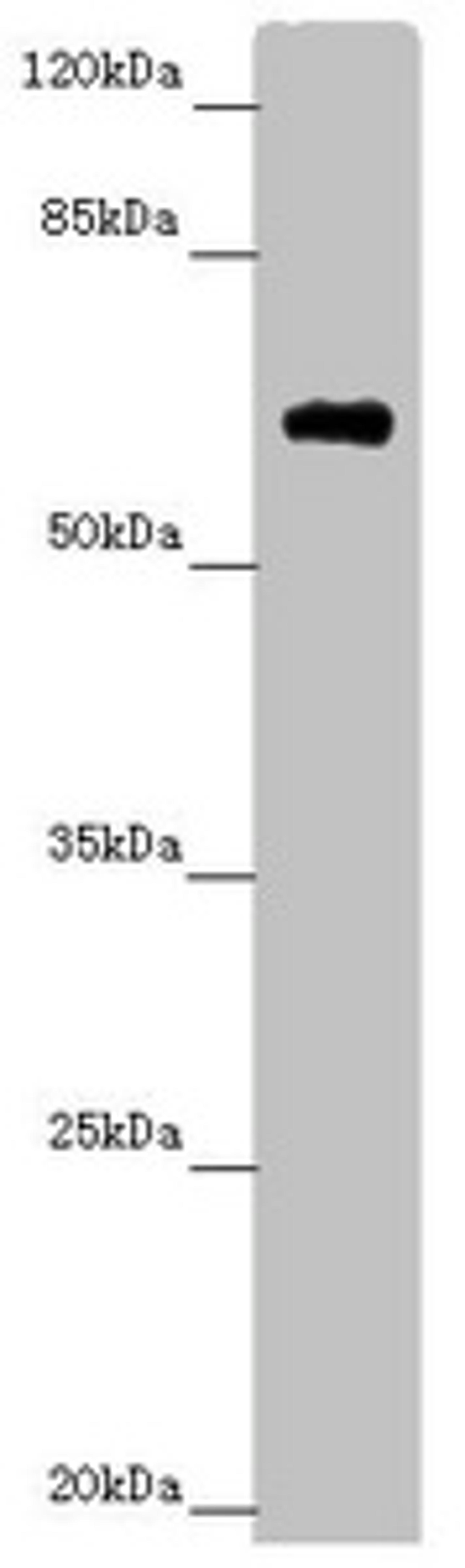 Western blot. All lanes: SOCS4 antibody at 4.25 ug/ml.  + Mouse kidney tissue. Secondary. Goat polyclonal to rabbit IgG at 1/10000 dilution. Predicted band size: 60 kDa. Observed band size: 60 kDa. 