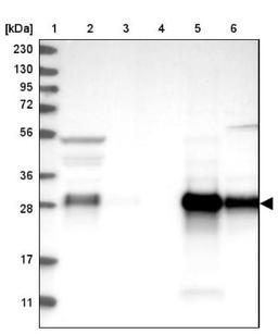 Western Blot: IFI30 Antibody [NBP1-83366] - Lane 1: Marker [kDa] 230, 130, 95, 72, 56, 36, 28, 17, 11<br/>Lane 2: Human cell line RT-4<br/>Lane 3: Human cell line U-251MG sp<br/>Lane 4: Human plasma (IgG/HSA depleted)<br/>Lane 5: Human liver tissue<br/>Lane 6: Human tonsil tissue