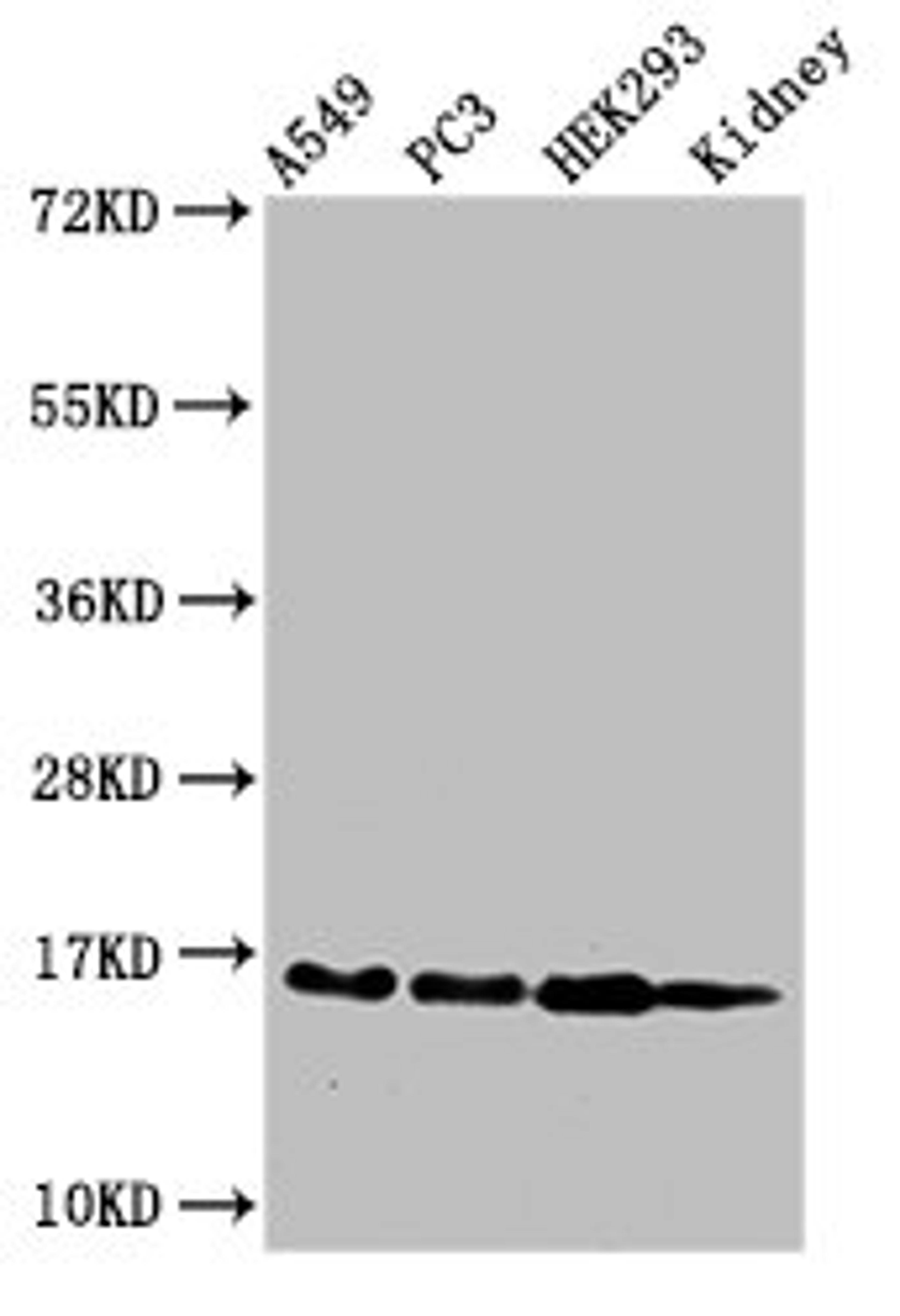 Western Blot. Positive WB detected in: A549 cell acid extracts, PC-3 cell acid extracts, HEK293 cell acid extracts, Mouse kidney tissue. All lanes: HIST1H3A antibody at 2µg/ml. Secondary. Goat polyclonal to rabbit IgG at 1/50000 dilution. Predicted band size: 16 kDa. Observed band size: 16 kDa