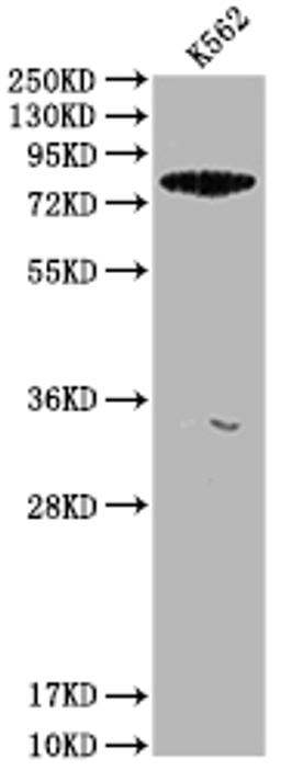 Western Blot. Positive WB detected in: K562 whole cell lysate. All lanes: ACSL6 antibody at 1:1000. Secondary. Goat polyclonal to rabbit IgG at 1/50000 dilution. Predicted band size: 78, 81, 75, 77, 80, 70 kDa. Observed band size: 78 kDa. 