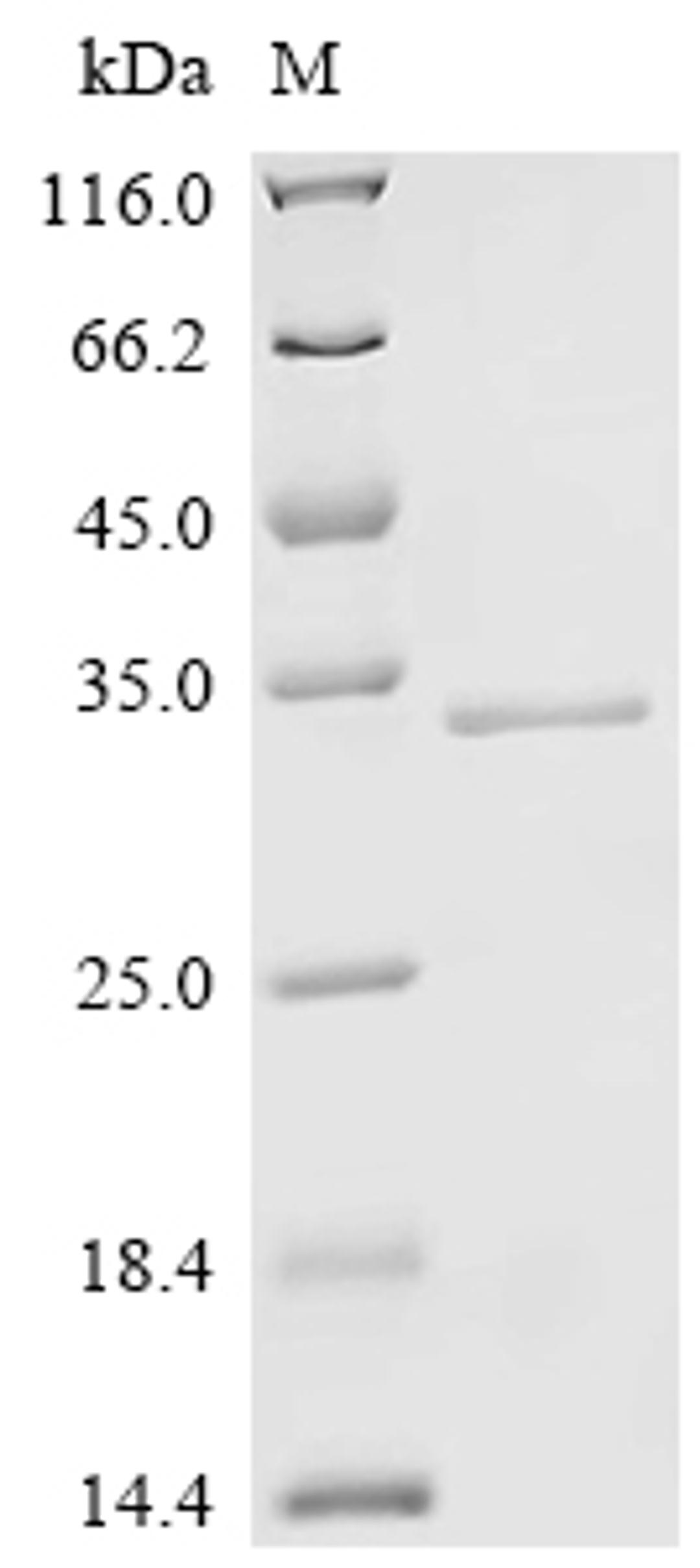 (Tris-Glycine gel) Discontinuous SDS-PAGE (reduced) with 5% enrichment gel and 15% separation gel.