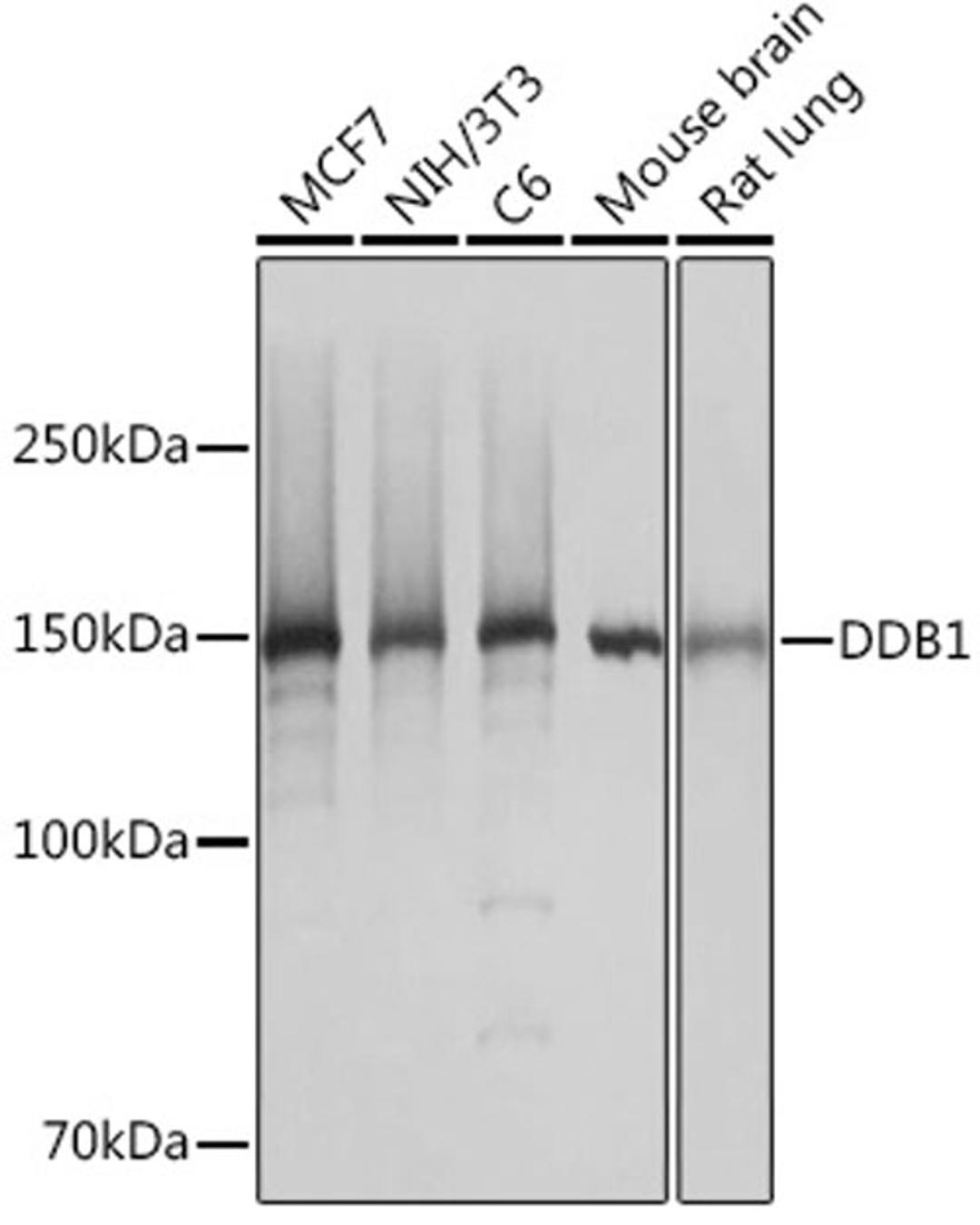 Western blot - DDB1 Rabbit mAb (A5022)