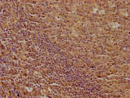 IHC image of CSB-PA013051OA01HU diluted at 1:100 and staining in paraffin-embedded human tonsil tissue performed on a Leica BondTM system. After dewaxing and hydration, antigen retrieval was mediated by high pressure in a citrate buffer (pH 6.0). Section was blocked with 10% normal goat serum 30min at RT. Then primary antibody (1% BSA) was incubated at 4°C overnight. The primary is detected by a biotinylated secondary antibody and visualized using an HRP conjugated SP system.