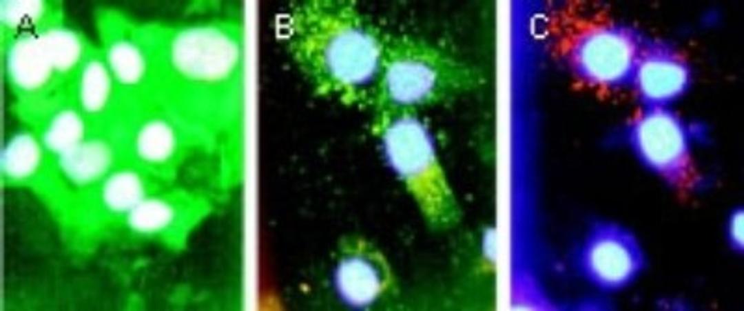 Immunocytochemistry/Immunofluorescence: Bad Antibody [NB100-56080] - Immunofluorescence microscopy of BAD using NB100-56080 at 1:2000. Du145 human prostate carcinoma cells were cultured without (A) or with (B) and (C) 1 uM of the triphosphatase inhibitor thapsigargin (THG) for 12 hr. A and B, staining with BAD antibody, followed by a FITC-conjugated secondary antibody. C, staining with a mitochondrial marker (antibody to mitochondrial Hsp60), followed by a rhodamine-conjugated secondary antibody. THG induces Ca2+ release from internal stores which can promote apoptosis. BAD staining was located diffusely throughout the cytoplasm of untreated cells (A), and localized to the mitochondria in treated cells (B).