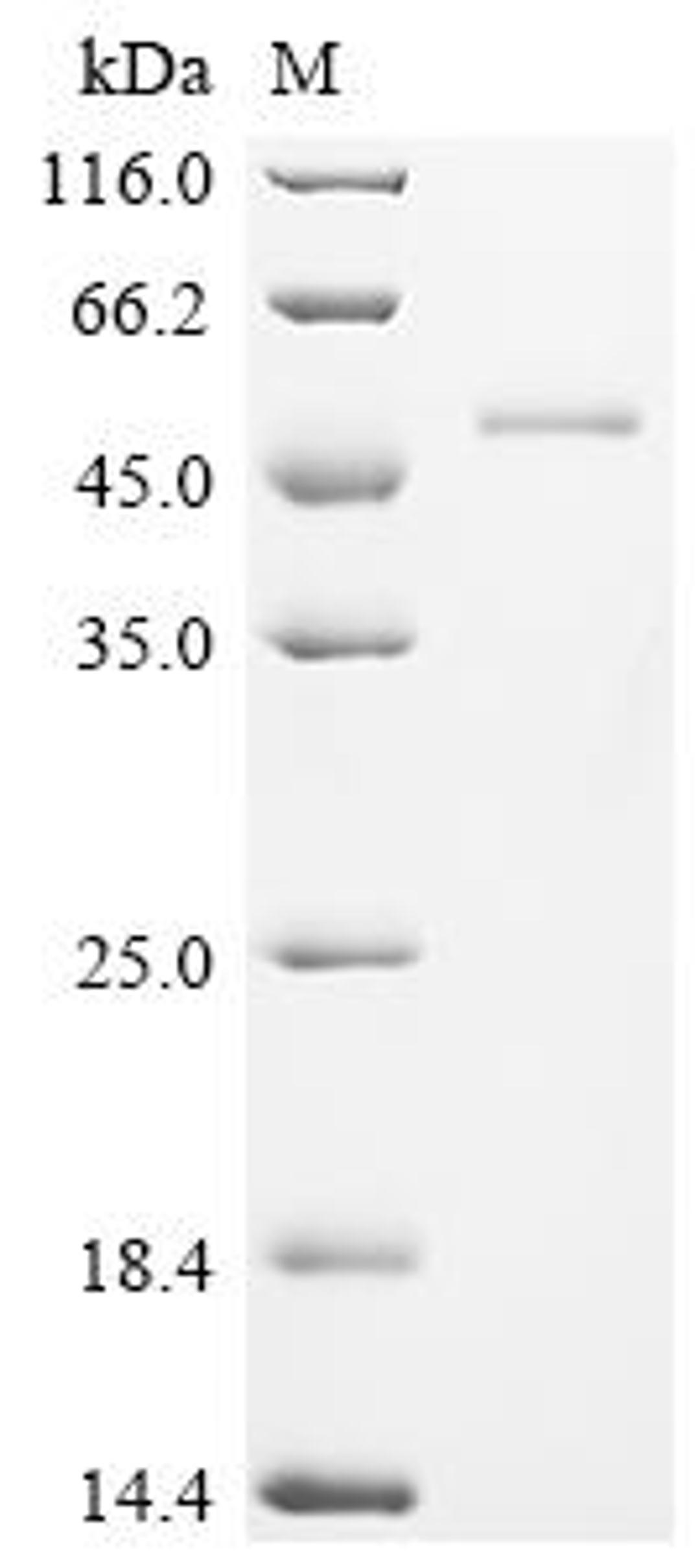 (Tris-Glycine gel) Discontinuous SDS-PAGE (reduced) with 5% enrichment gel and 15% separation gel.