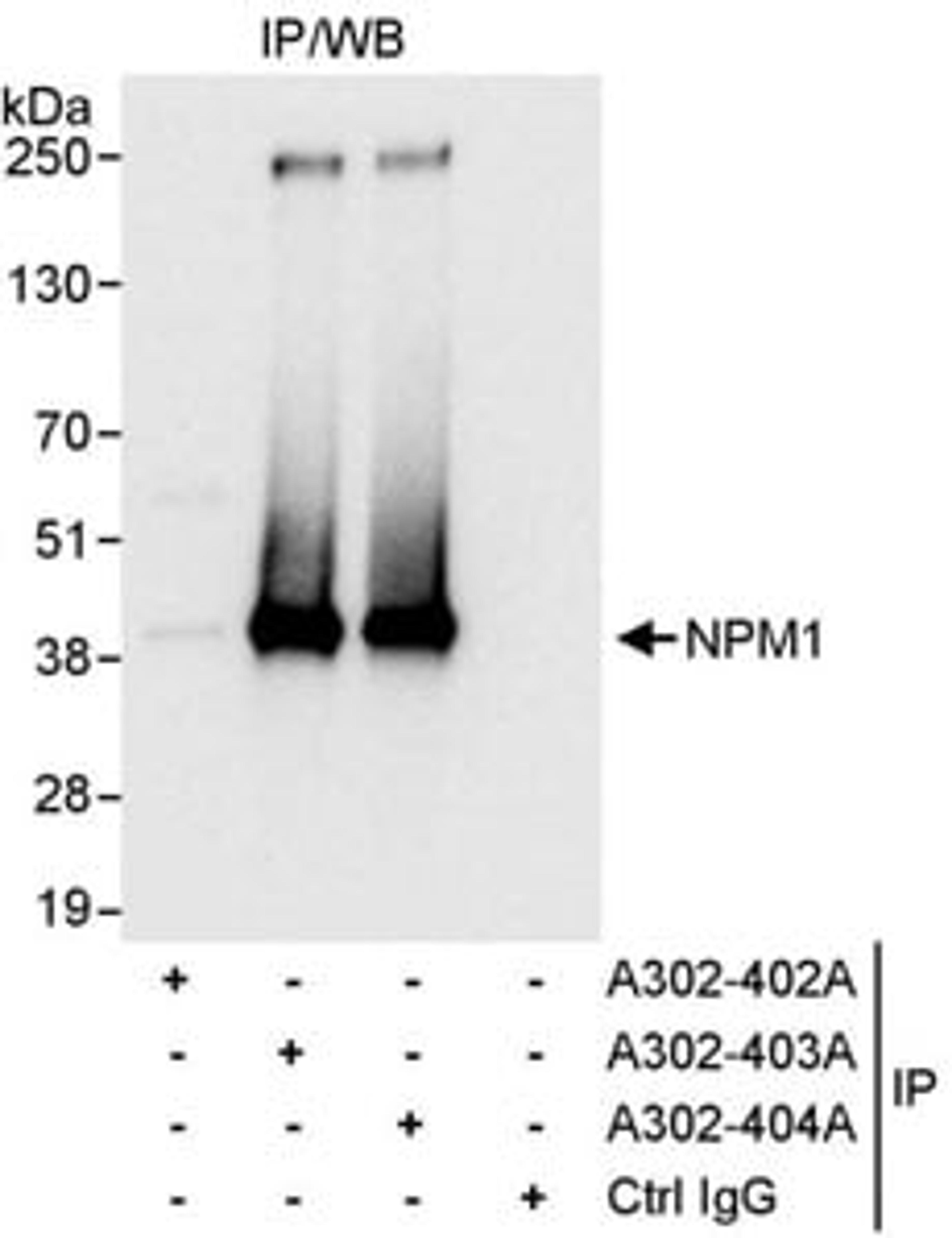 Detection of human NPM1 by western blot of immunoprecipitates.