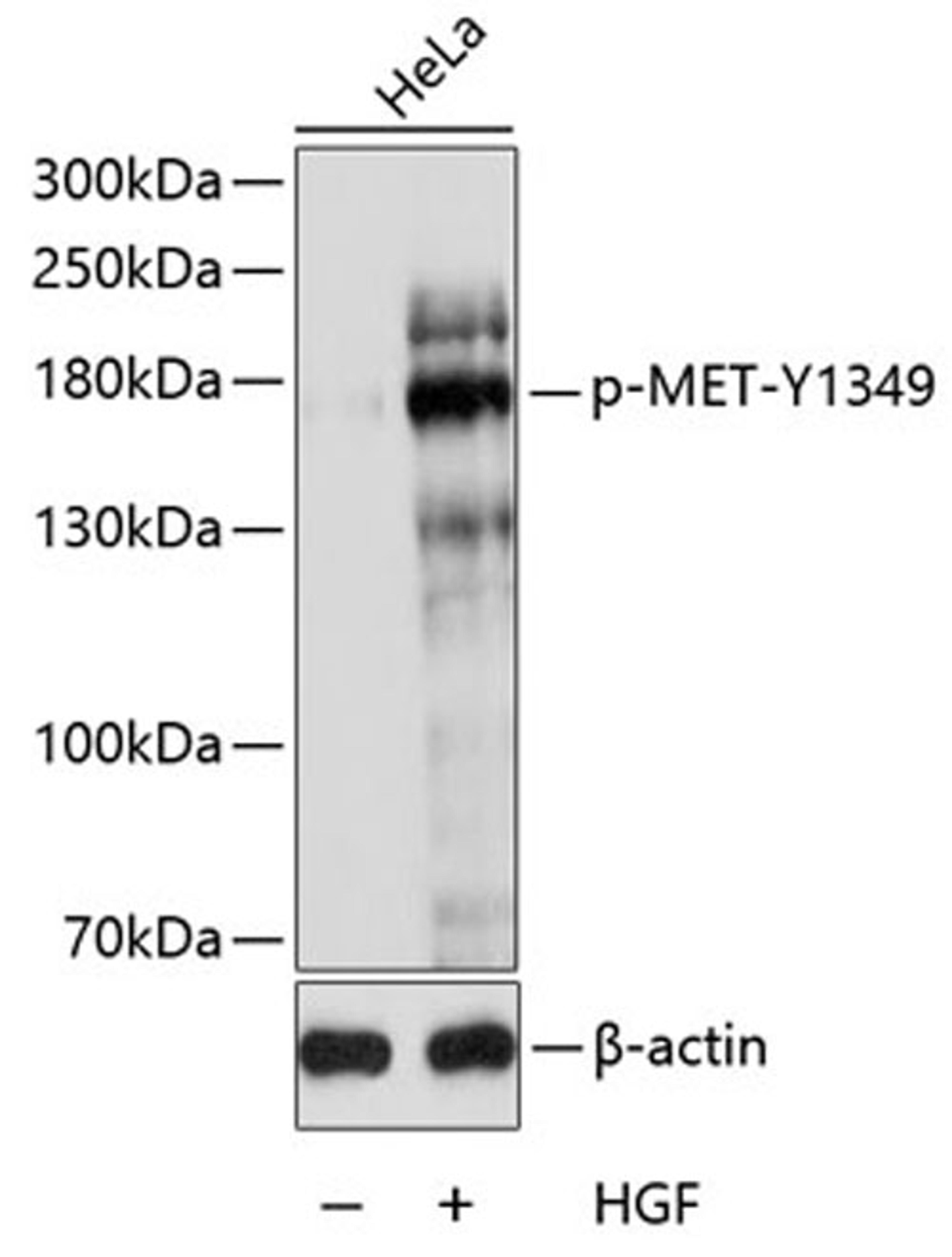 Western blot - Phospho-MET-Y1349 antibody (AP0077)