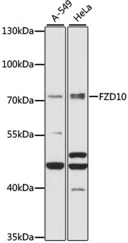 Western blot - FZD10 antibody (A15399)