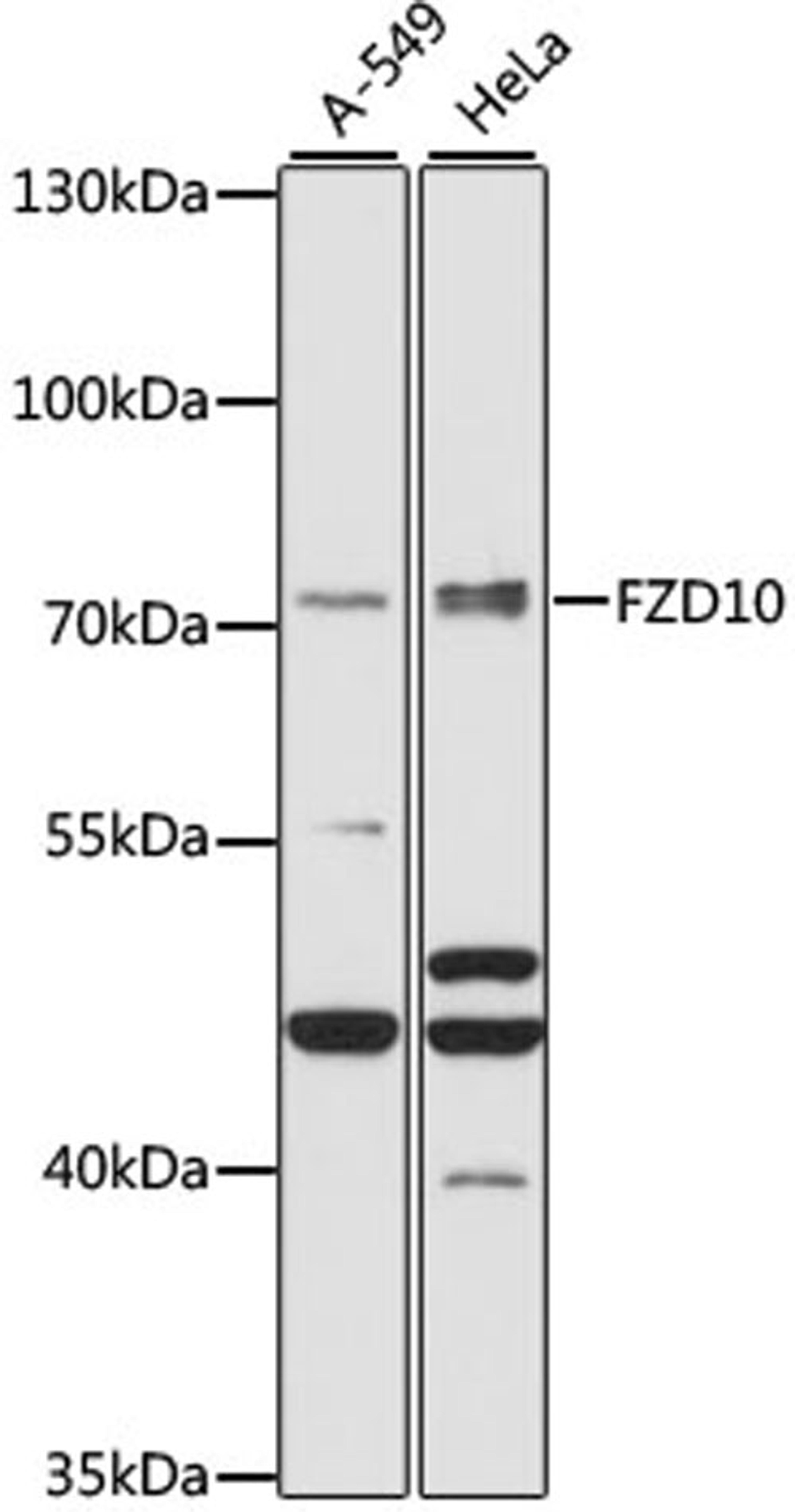 Western blot - FZD10 antibody (A15399)