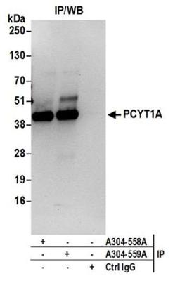 Detection of human PCYT1A by western blot of immunoprecipitates.