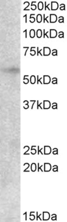 45-521 (2ug/ml) staining of lysates of cell line HepG2 (35ug protein in RIPA buffer). Primary incubation was 1 hour. Detected by chemiluminescence.