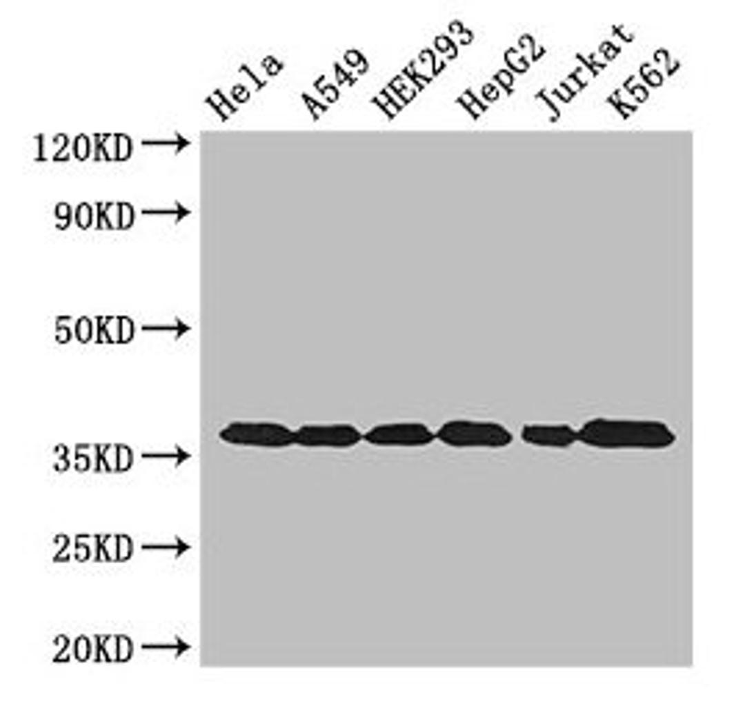 Western Blot. Positive WB detected in: Hela whole cell lysate, A549 whole cell lysate, HEK293 whole cell lysate, HepG2 whole cell lysate, Jurkat whole cell lysate, K562 whole cell lysate. All lanes: GAPDH antibody at 3µg/ml. Secondary. Goat polyclonal to rabbit IgG at 1/50000 dilution. Predicted band size: 37, 32 kDa. Observed band size: 37 kDa
