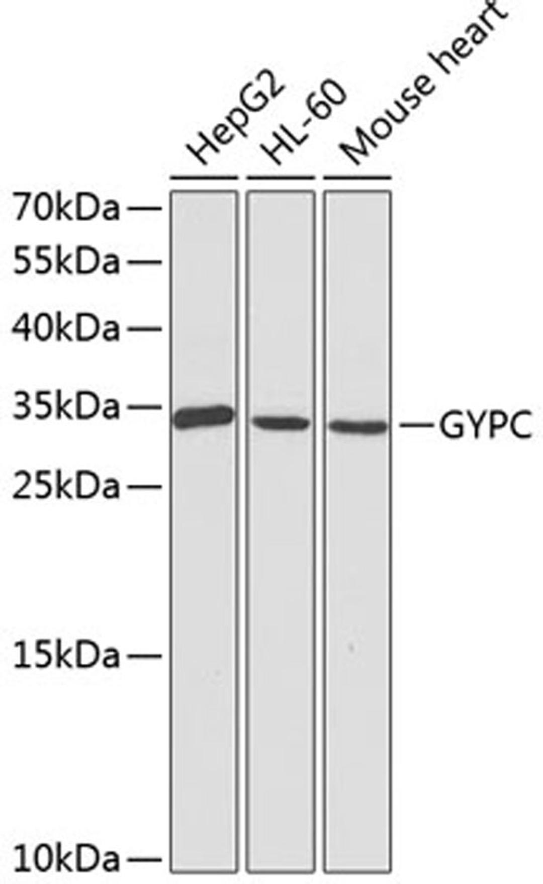 Western blot - GYPC antibody (A1232)