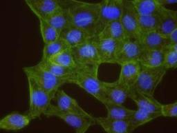 Proximity Ligation Assay: Casein Kinase 2 alpha Antibody [NB100-376] - Secondary-conjugate Duolink in Situ PLA in Hela cells. goat anti-human CHK1 (NB100-311) and rabbit anti-human CK11 alpha (NB100-376). Image merged from DAPI (2ms), FITC/Green (25ms) and TRITC/Orange (250ms) exposures, 40X magnification. Control images may not have counterstained cytoplasm.