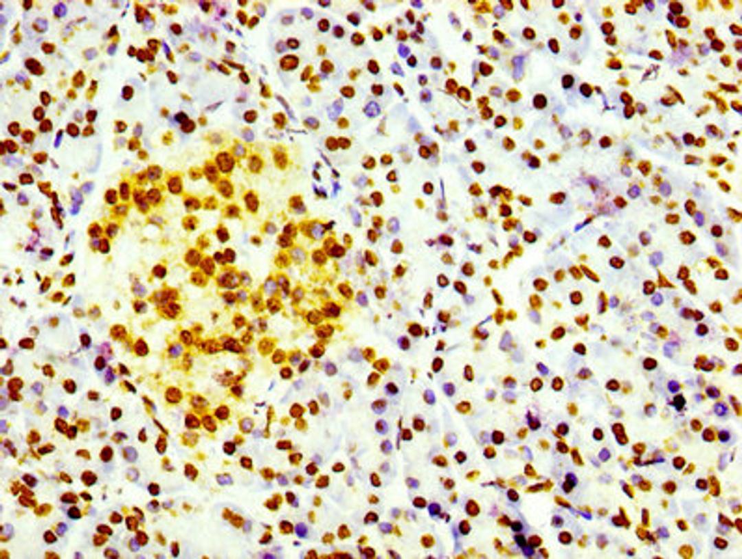 IHC image of CSB-RA010109A0HU diluted at 1:100 and staining in paraffin-embedded human pancreatic tissue performed on a Leica BondTM system. After dewaxing and hydration, antigen retrieval was mediated by high pressure in a citrate buffer (pH 6.0). Section was blocked with 10% normal goat serum 30min at RT. Then primary antibody (1% BSA) was incubated at 4℃ overnight. The primary is detected by a biotinylated secondary antibody and visualized using an HRP conjugated SP system.