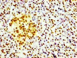 IHC image of CSB-RA010109A0HU diluted at 1:100 and staining in paraffin-embedded human pancreatic tissue performed on a Leica BondTM system. After dewaxing and hydration, antigen retrieval was mediated by high pressure in a citrate buffer (pH 6.0). Section was blocked with 10% normal goat serum 30min at RT. Then primary antibody (1% BSA) was incubated at 4℃ overnight. The primary is detected by a biotinylated secondary antibody and visualized using an HRP conjugated SP system.