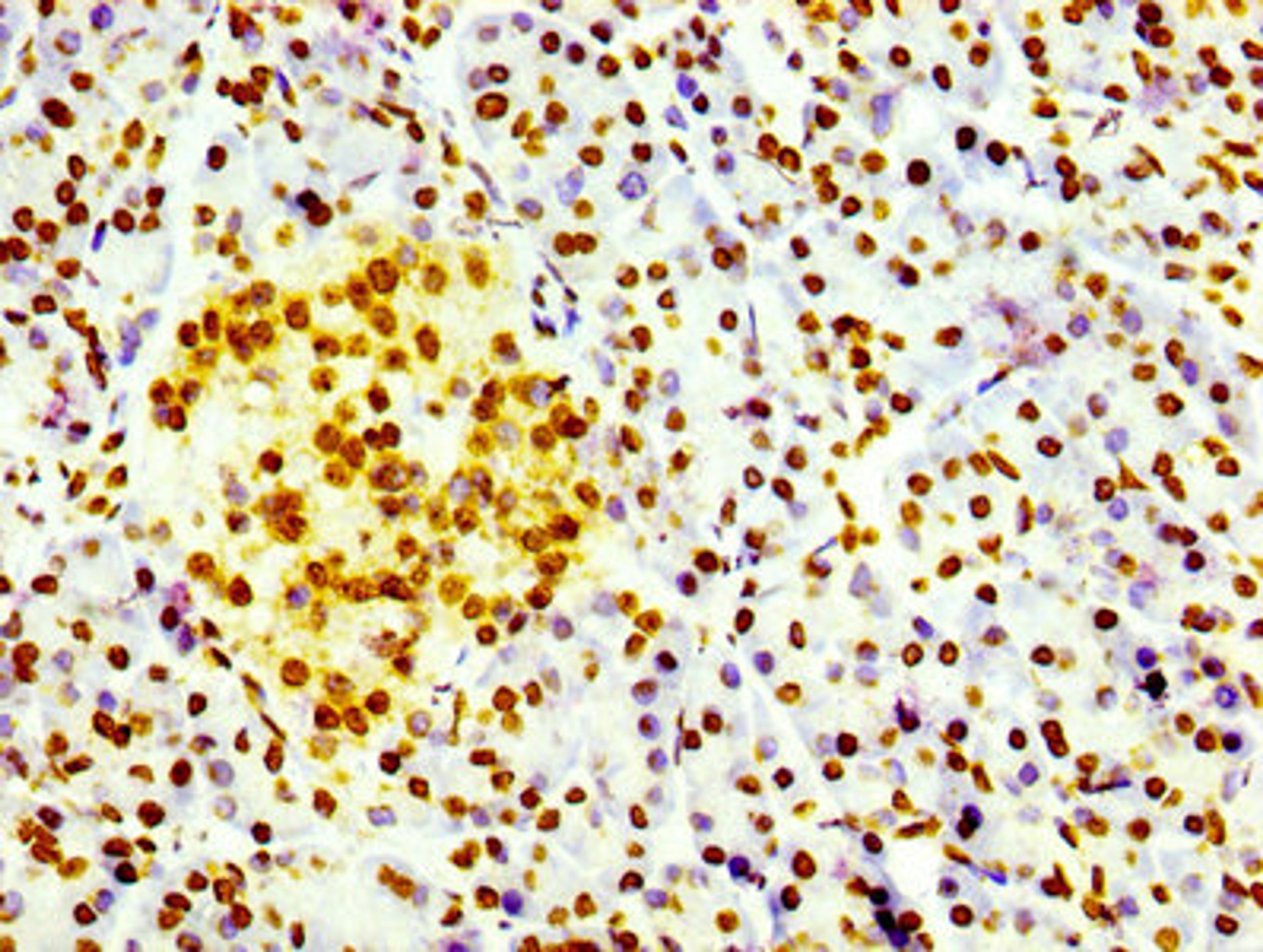 IHC image of CSB-RA010109A0HU diluted at 1:100 and staining in paraffin-embedded human pancreatic tissue performed on a Leica BondTM system. After dewaxing and hydration, antigen retrieval was mediated by high pressure in a citrate buffer (pH 6.0). Section was blocked with 10% normal goat serum 30min at RT. Then primary antibody (1% BSA) was incubated at 4℃ overnight. The primary is detected by a biotinylated secondary antibody and visualized using an HRP conjugated SP system.