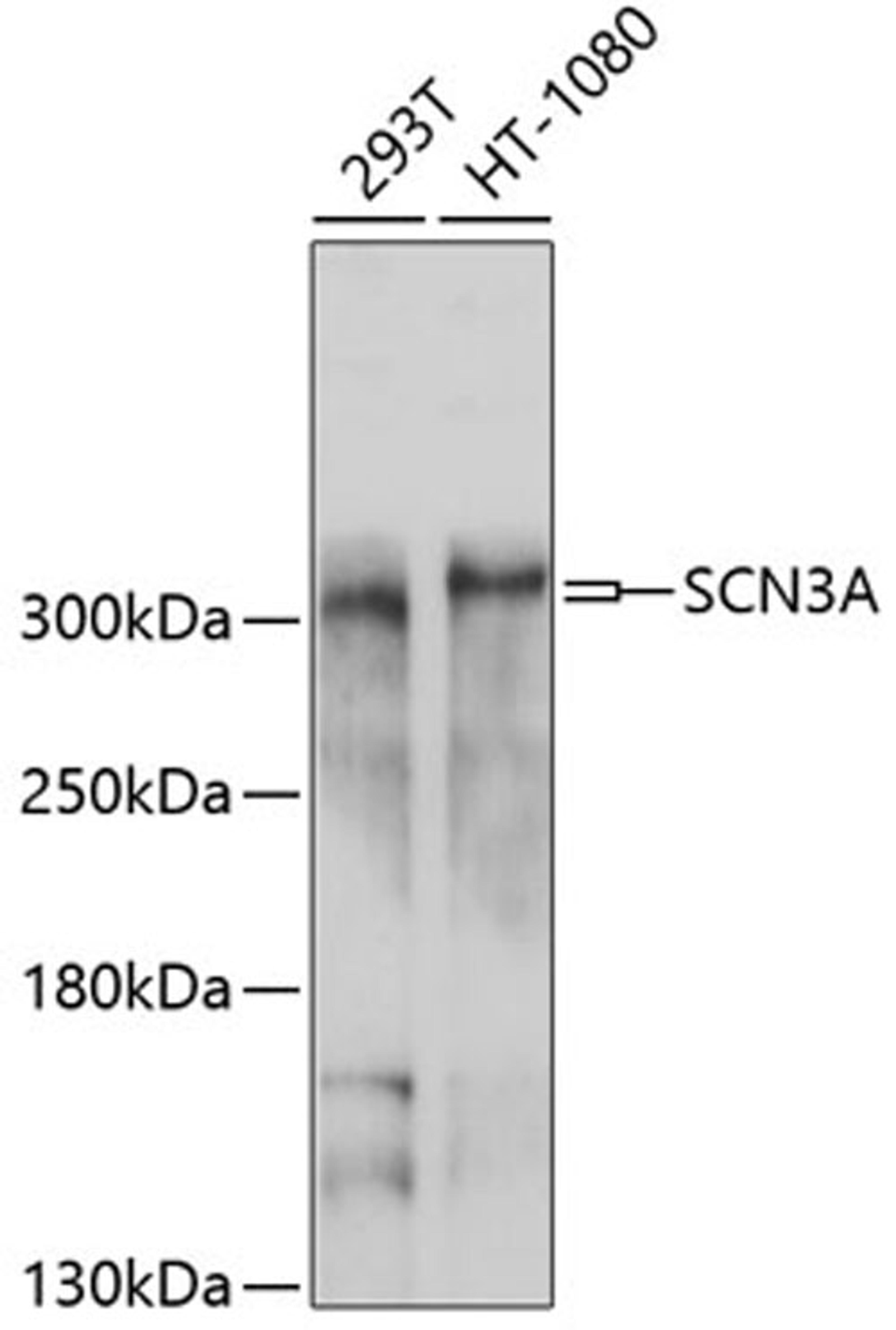 Western blot - SCN3A antibody (A10072)