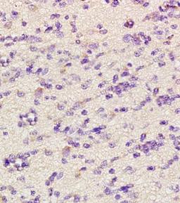 IHC-P of human glioma tissue (CHRNA4 antibody at 1:300)