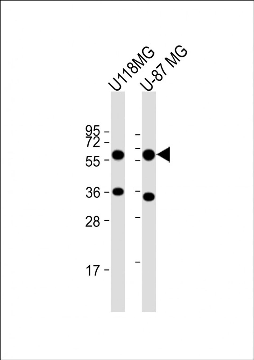 Western Blot at 1:1000 dilution Lane 1: U118MG whole cell lysate Lane 2: U-87 MG whole cell lysate Lysates/proteins at 20 ug per lane.