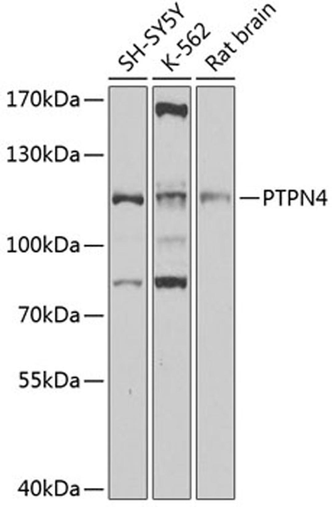 Western blot - PTPN4 antibody (A4061)