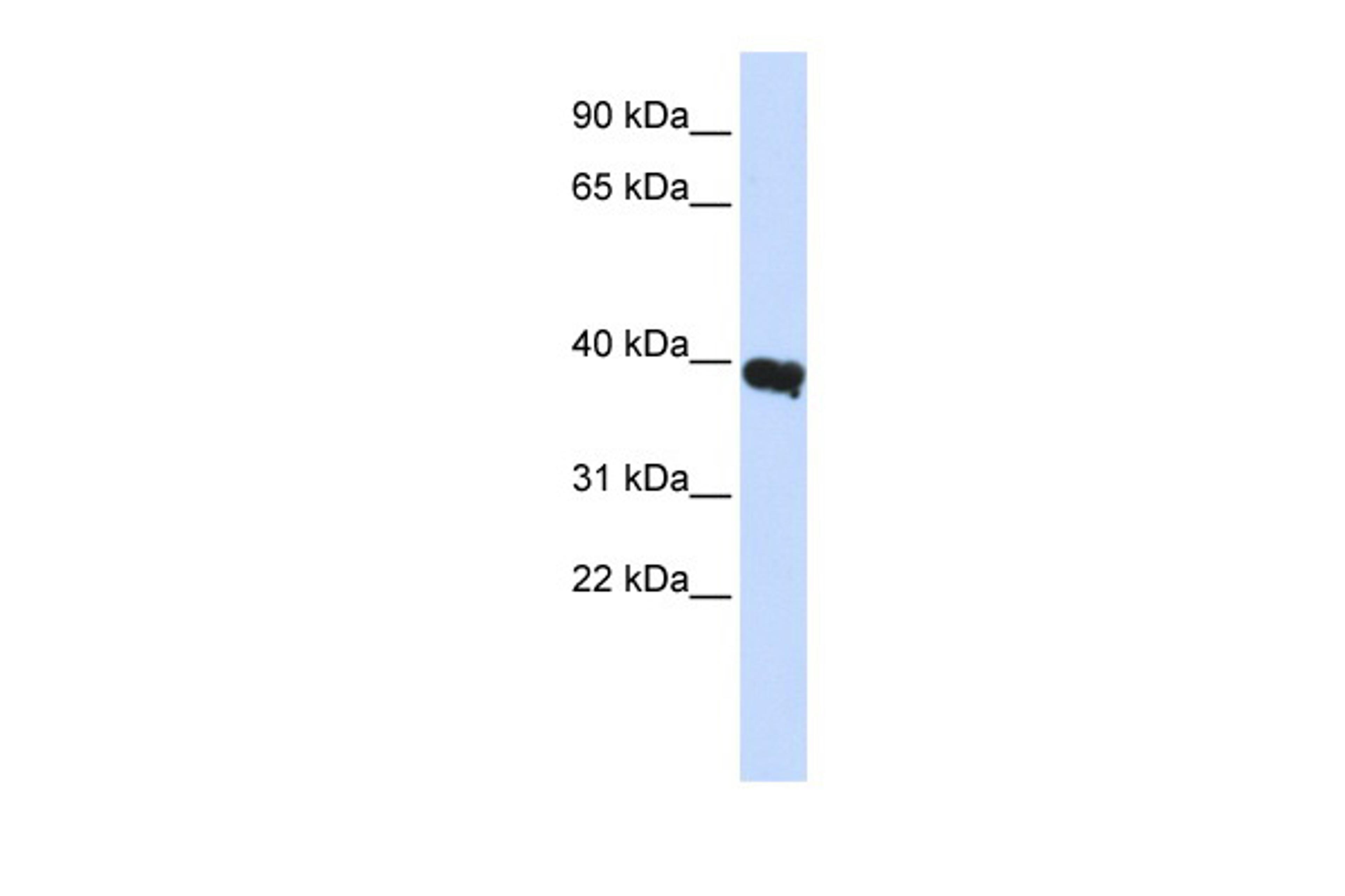 Antibody used in WB on Human Liver at 0.2-1 ug/ml.