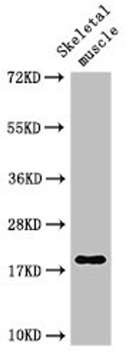 Western Blot. Positive WB detected in: Rat skeletal muscle tissue. All lanes: TNNC1 antibody at 3ug/ml. Secondary. Goat polyclonal to rabbit IgG at 1/50000 dilution. Predicted band size: 19 kDa. Observed band size: 19 kDa. 