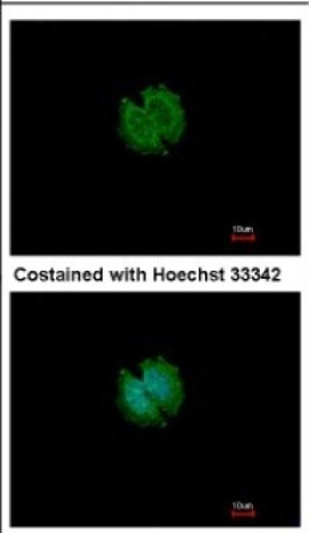 Immunocytochemistry/Immunofluorescence: CATSPERB Antibody [NBP2-15728] - Immunofluorescence analysis of methanol-fixed A431, using antibody at 1:500 dilution.