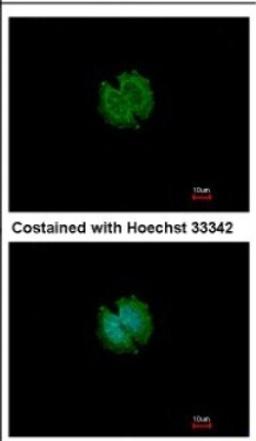 Immunocytochemistry/Immunofluorescence: CATSPERB Antibody [NBP2-15728] - Immunofluorescence analysis of methanol-fixed A431, using antibody at 1:500 dilution.