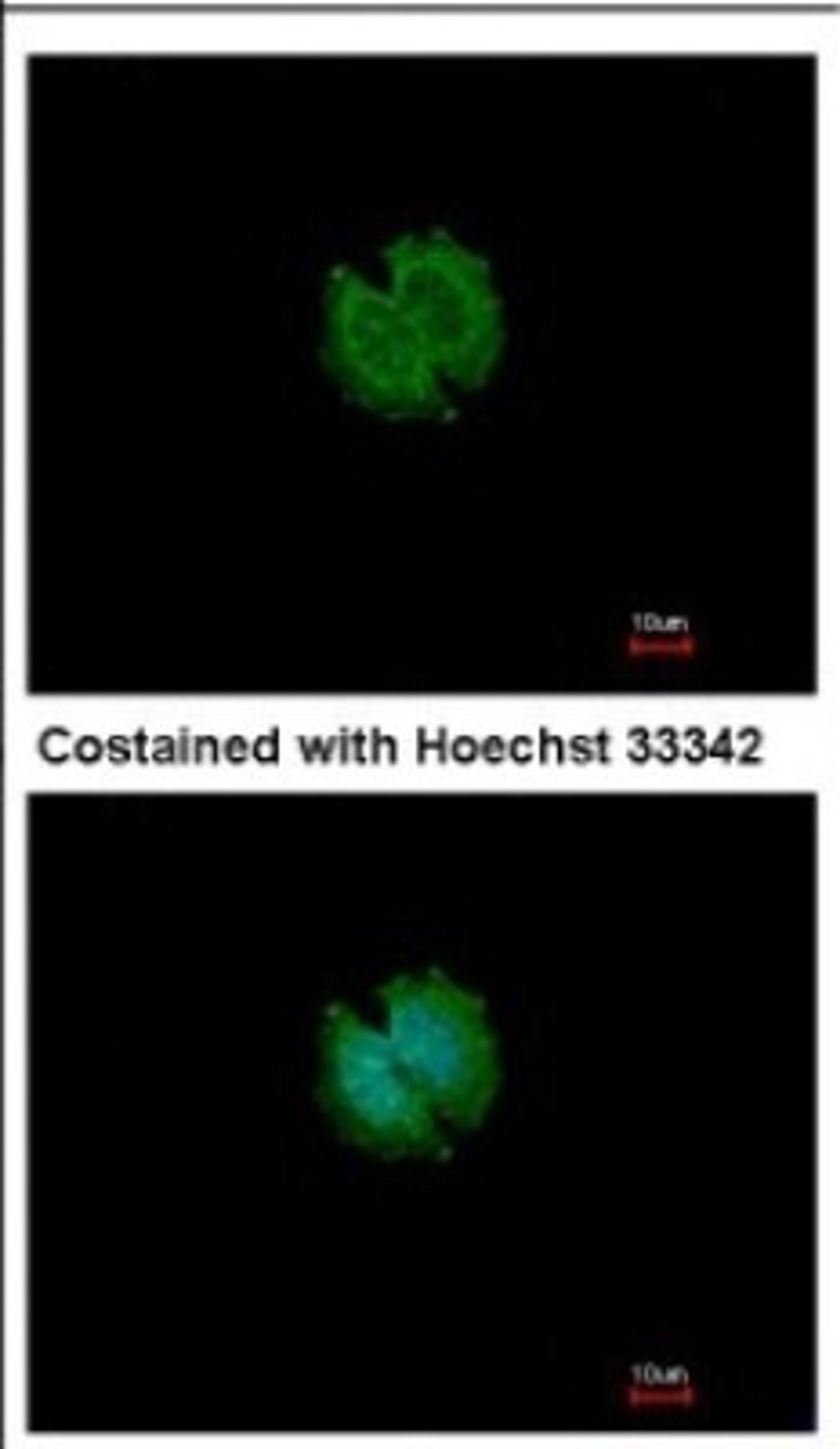 Immunocytochemistry/Immunofluorescence: CATSPERB Antibody [NBP2-15728] - Immunofluorescence analysis of methanol-fixed A431, using antibody at 1:500 dilution.