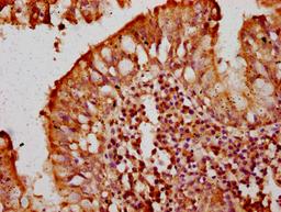 IHC image of CSB-PA615690LA01HU diluted at 1:300 and staining in paraffin-embedded human lung tissue performed on a Leica BondTM system. After dewaxing and hydration, antigen retrieval was mediated by high pressure in a citrate buffer (pH 6.0). Section was blocked with 10% normal goat serum 30min at RT. Then primary antibody (1% BSA) was incubated at 4&deg;C overnight. The primary is detected by a biotinylated secondary antibody and visualized using an HRP conjugated SP system.