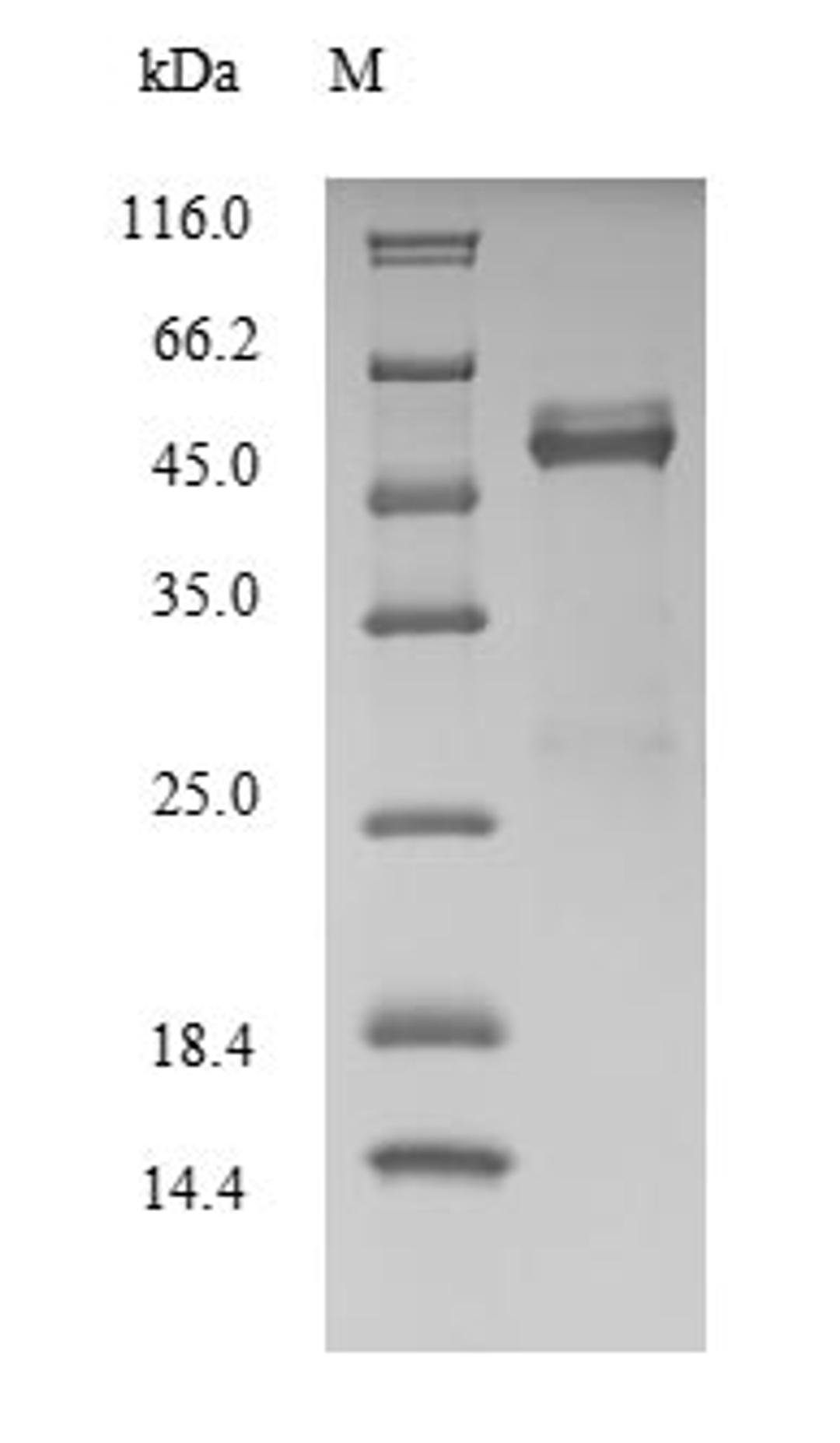 (Tris-Glycine gel) Discontinuous SDS-PAGE (reduced) with 5% enrichment gel and 15% separation gel.
