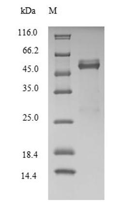 (Tris-Glycine gel) Discontinuous SDS-PAGE (reduced) with 5% enrichment gel and 15% separation gel.