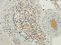 IHC-P image of guinea pig lung tissue using TRAPPC11 antibody (2.5 ug/ml)