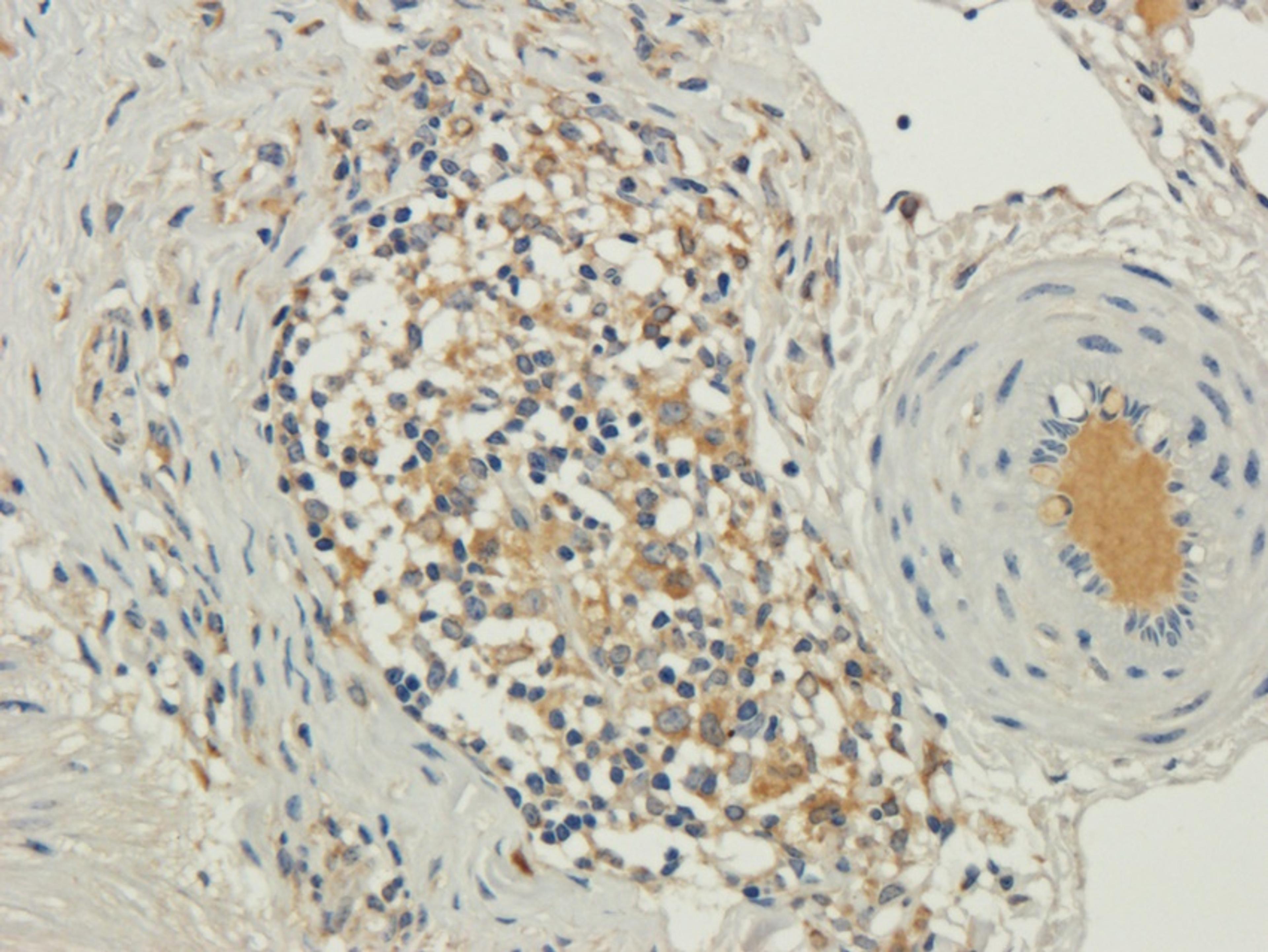 IHC-P image of guinea pig lung tissue using TRAPPC11 antibody (2.5 ug/ml)