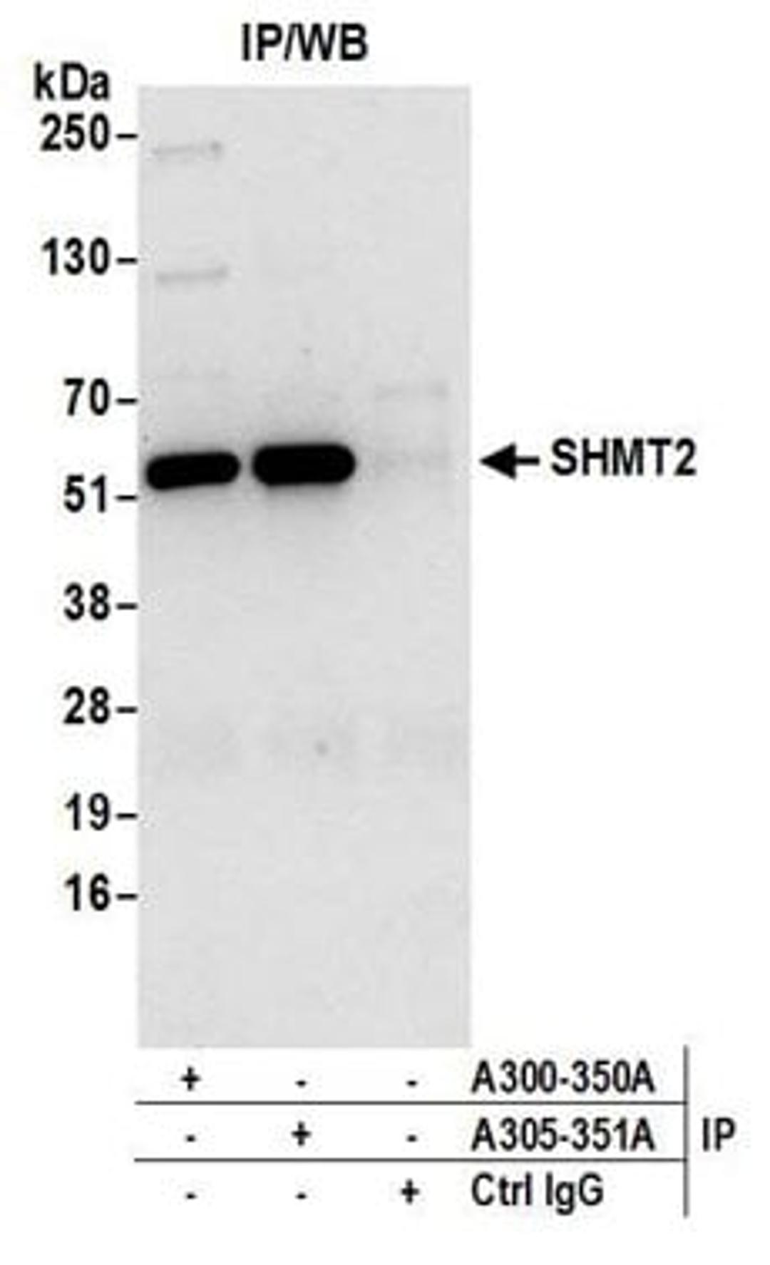 Detection of human SHMT2 by western blot of immunoprecipitates.