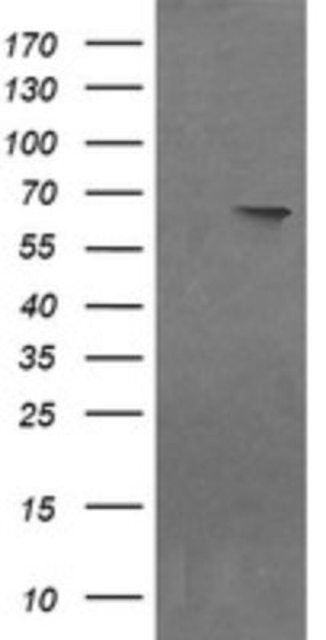 Western Blot: NDOR1 Antibody (1E3) [NBP2-45856] - Analysis of HEK293T cells were transfected with the pCMV6-ENTRY control (Left lane) or pCMV6-ENTRY NDOR1.