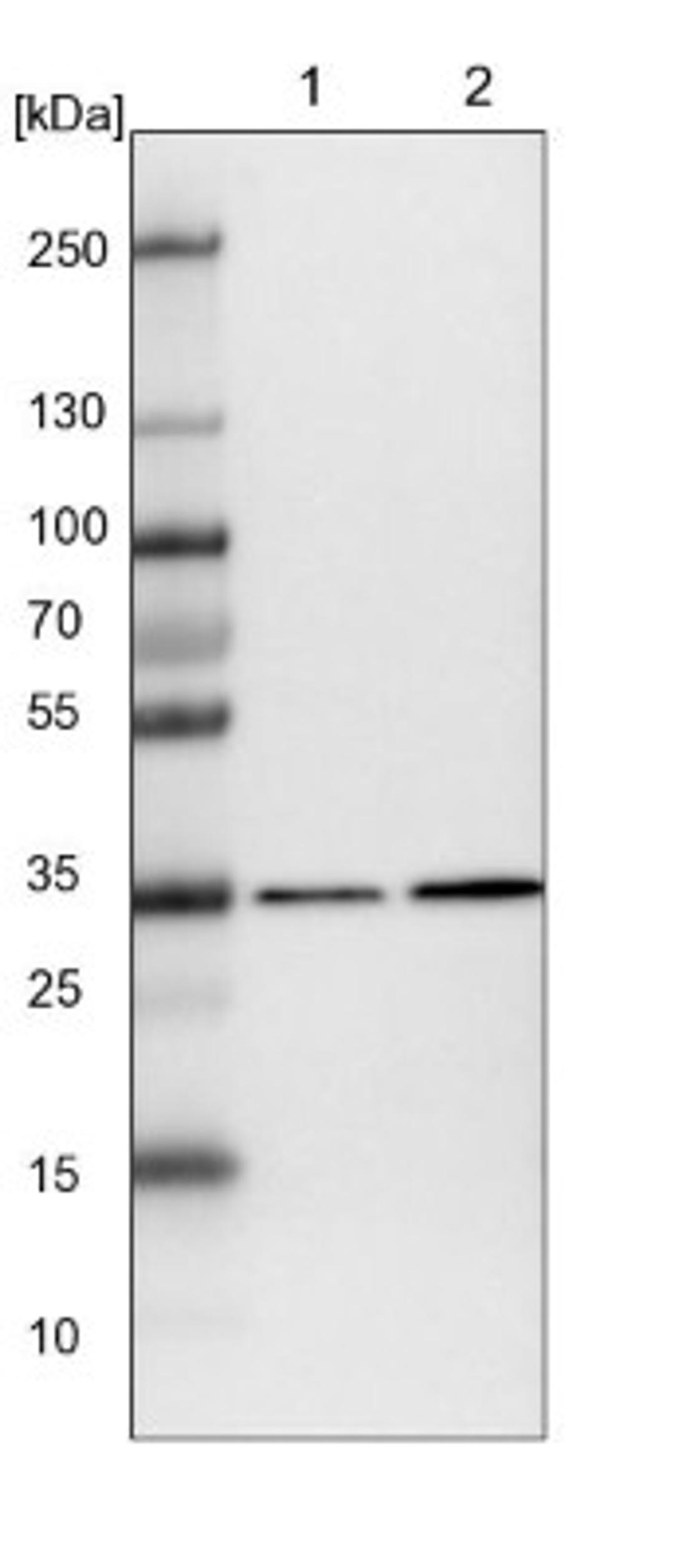 Western Blot: MDH1 Antibody [NBP1-89515] - Lane 1: NIH-3T3 cell lysate (Mouse embryonic fibroblast cells)<br/>Lane 2: NBT-II cell lysate (Rat Wistar bladder tumour cells)