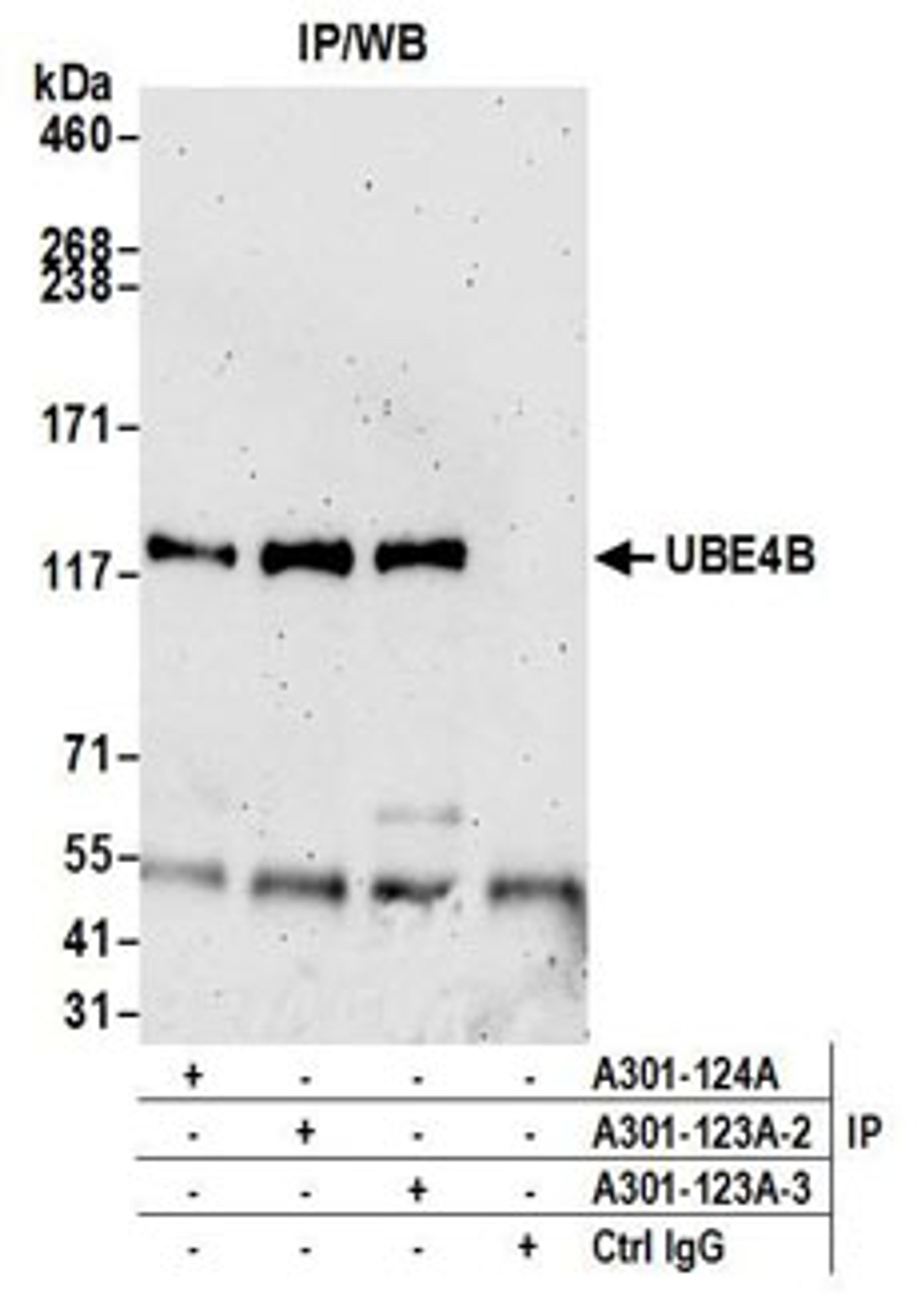 Detection of human UBE4B by western blot of immunoprecipitates.