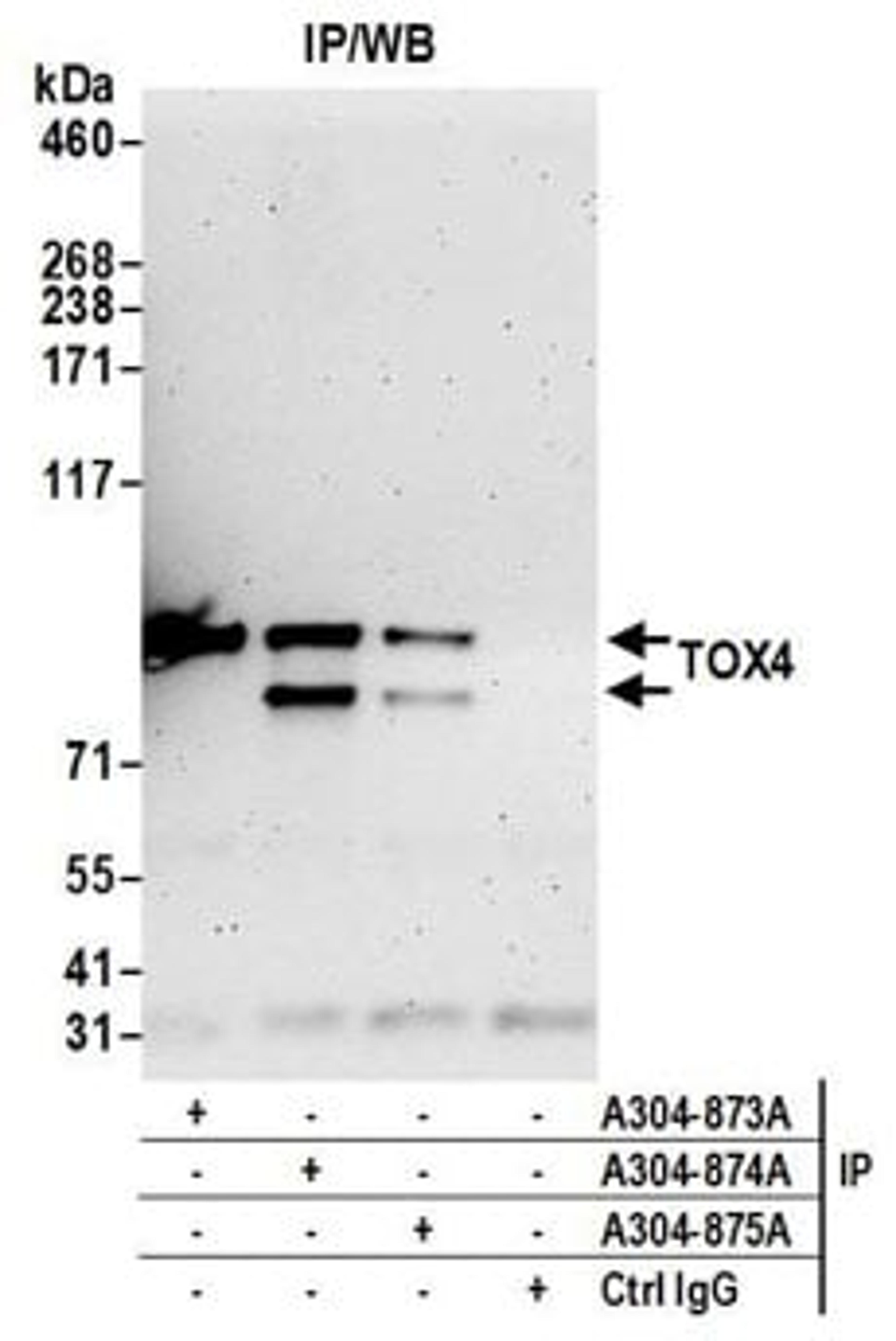 Detection of human TOX4 by western blot of immunoprecipitates.