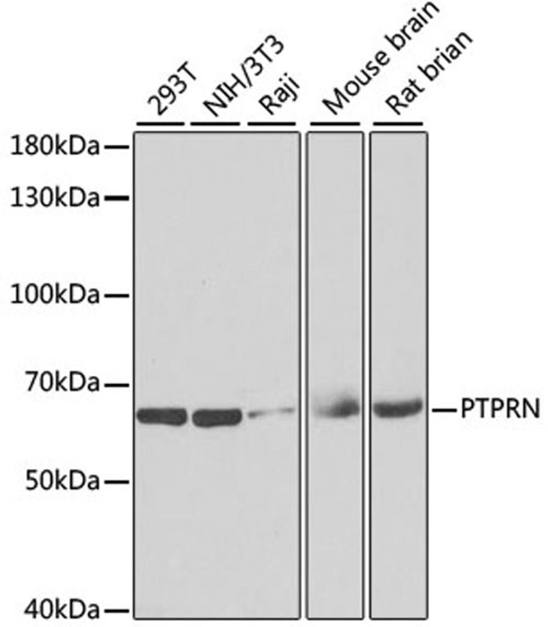 Western blot - PTPRN antibody (A6401)