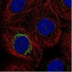 Immunocytochemistry/Immunofluorescence: MPP2 Antibody [NBP1-85038] - Immunofluorescent staining of human cell line A-431 shows positivity in mitochondria.