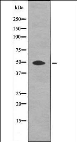 Western blot analysis of UV treated A2780 whole cell lysates using HtrA2 -Phospho-Ser212- antibody