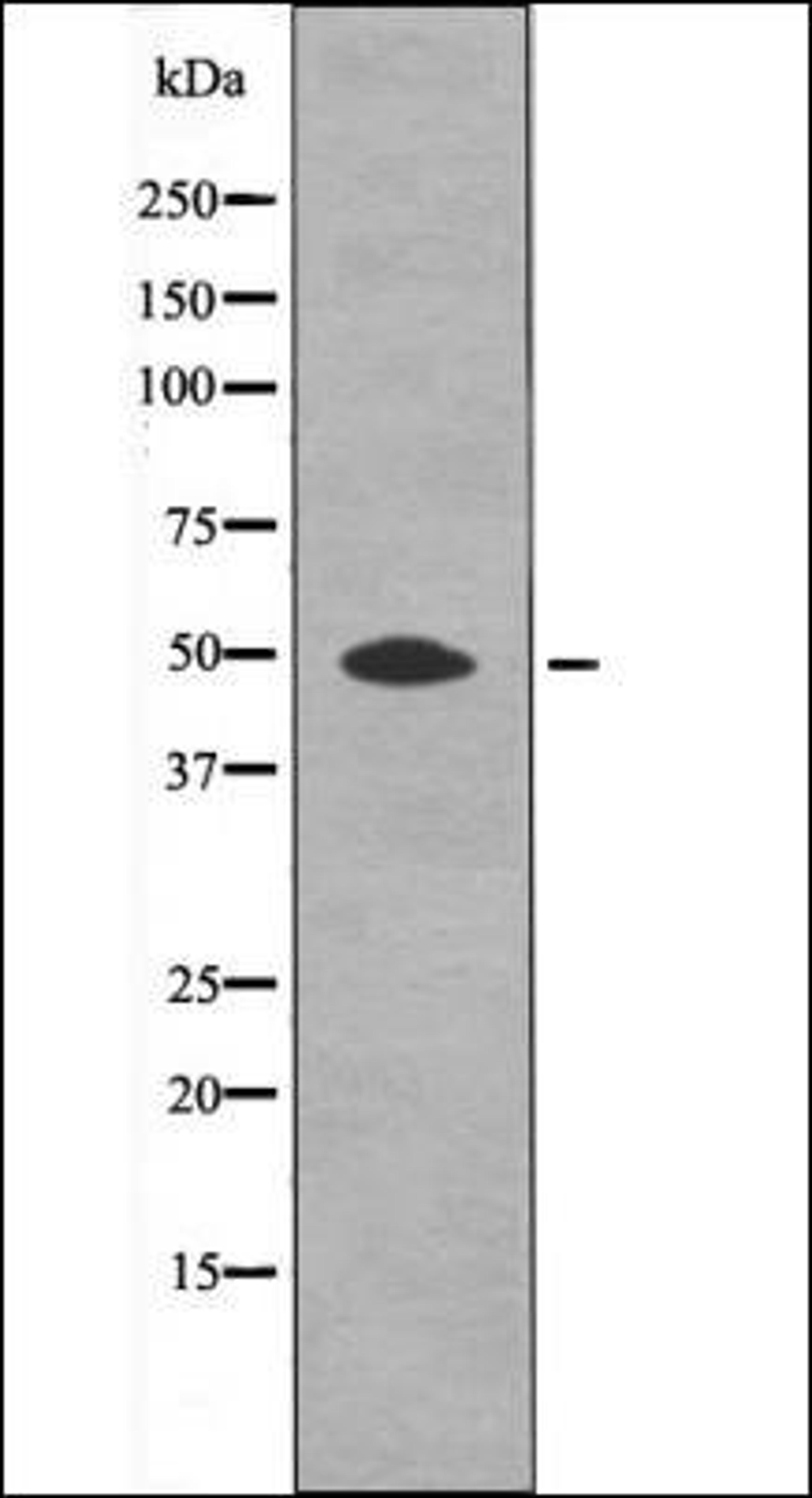 Western blot analysis of UV treated A2780 whole cell lysates using HtrA2 -Phospho-Ser212- antibody