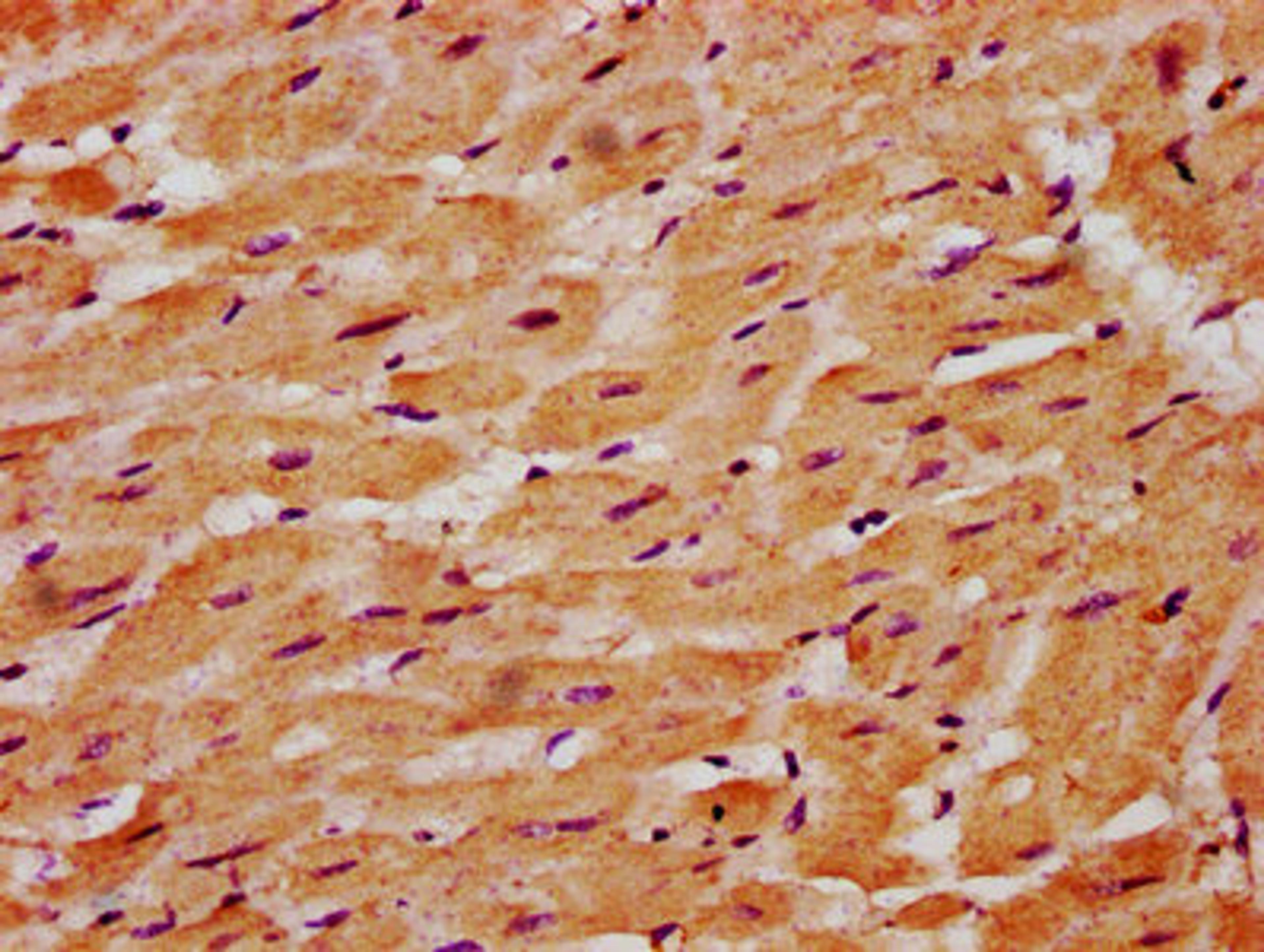IHC image of CSB-PA618771LA01HU diluted at 1:500 and staining in paraffin-embedded human heart tissue performed on a Leica BondTM system. After dewaxing and hydration, antigen retrieval was mediated by high pressure in a citrate buffer (pH 6.0). Section was blocked with 10% normal goat serum 30min at RT. Then primary antibody (1% BSA) was incubated at 4&deg;C overnight. The primary is detected by a biotinylated secondary antibody and visualized using an HRP conjugated SP system.