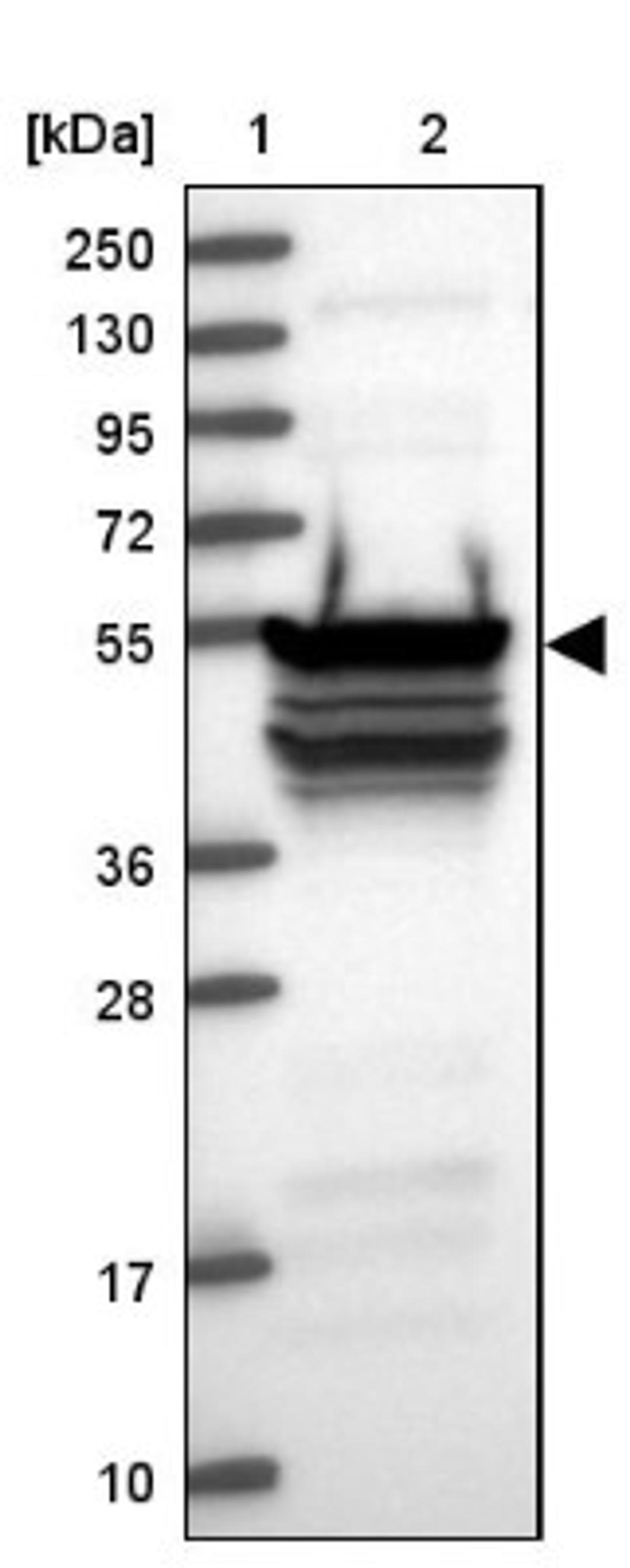 Western Blot: RBM41 Antibody [NBP1-83788] - Lane 1: Marker [kDa] 250, 130, 95, 72, 55, 36, 28, 17, 10<br/>Lane 2: Human cell line RT-4